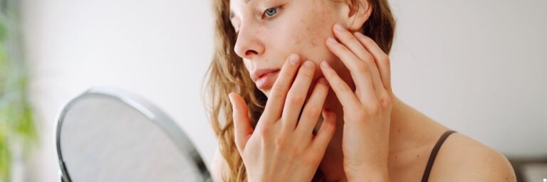 Cilt Yorgunluğu Nedir, Nasıl Giderilir