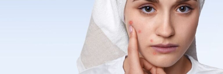 Hassas Ciltler İçin Uygun Günlük Bakım Rutini