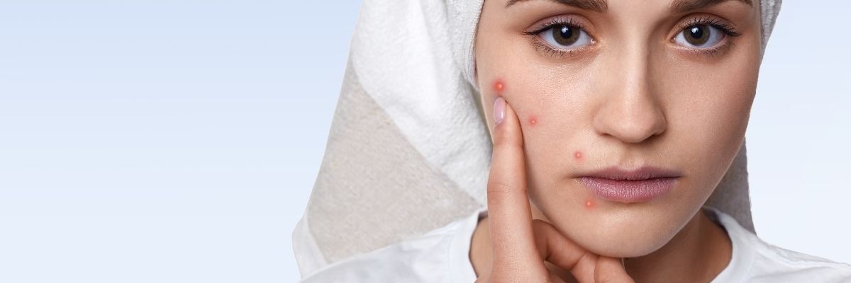 Hassas Ciltler İçin Uygun Günlük Bakım Rutini