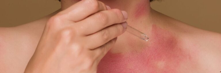 Ciltte Görülen Vitamin Eksikliği Belirtileri